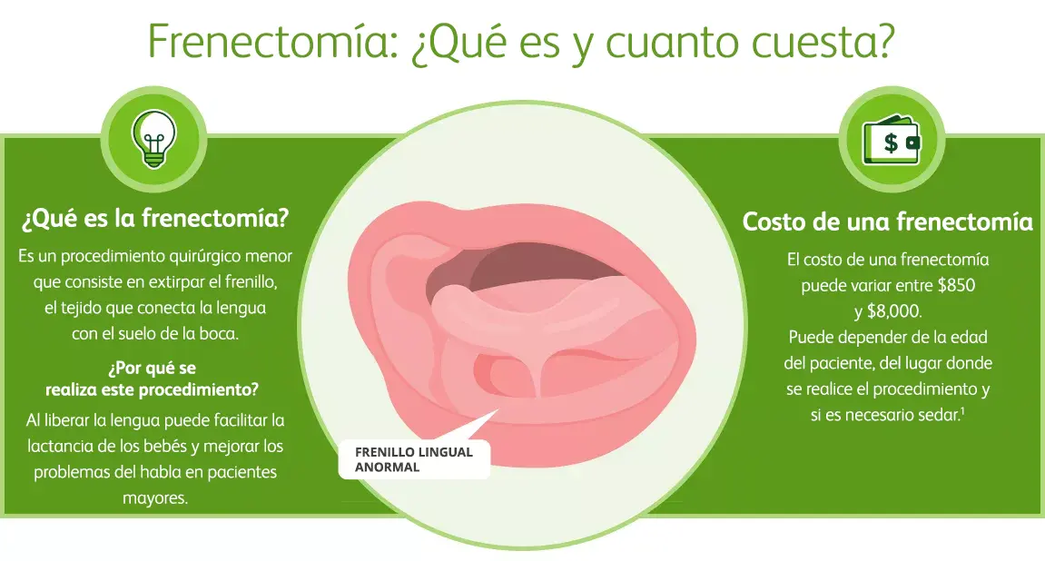 Illustration of the frenulum, a small strand of tissue that connects the tongue to the bottom of the mouth